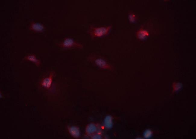 Cardiac Troponin T Antibody in Immunocytochemistry (ICC/IF)