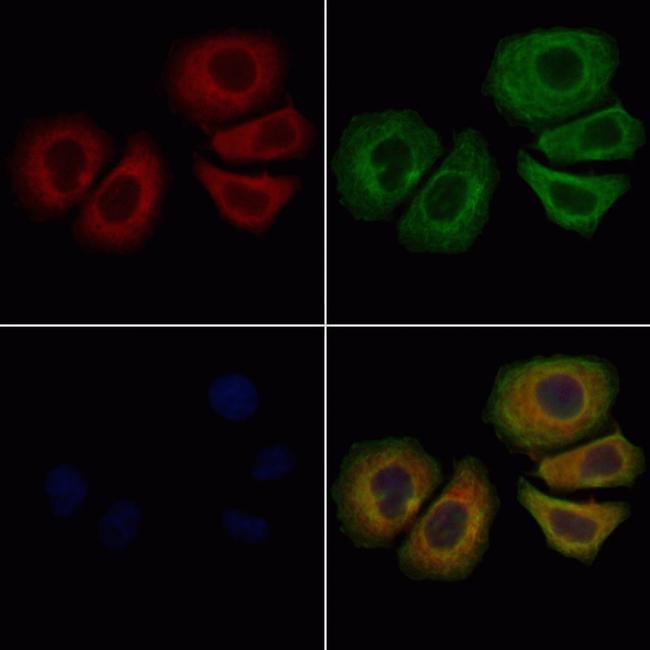 RRM1 Antibody in Immunocytochemistry (ICC/IF)