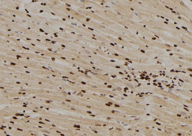 MAD1 Antibody in Immunohistochemistry (Paraffin) (IHC (P))