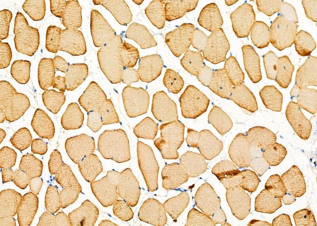 TPM1 Antibody in Immunohistochemistry (Paraffin) (IHC (P))