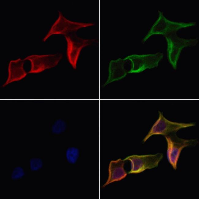 GluR3 Antibody in Immunocytochemistry (ICC/IF)