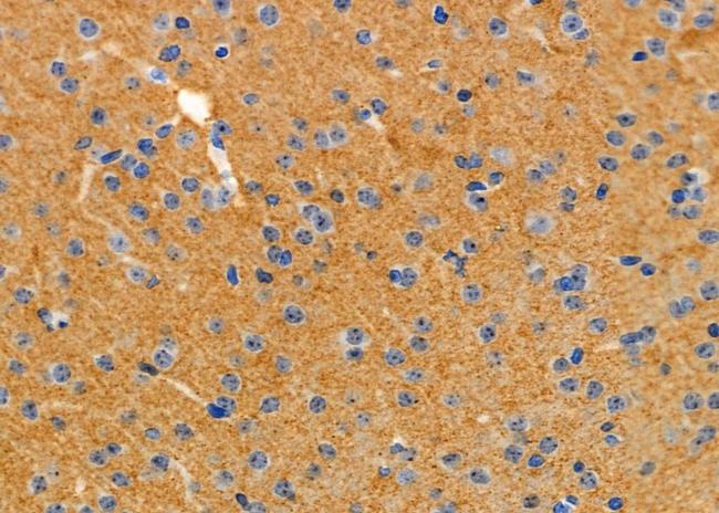 SRPX Antibody in Immunohistochemistry (Paraffin) (IHC (P))