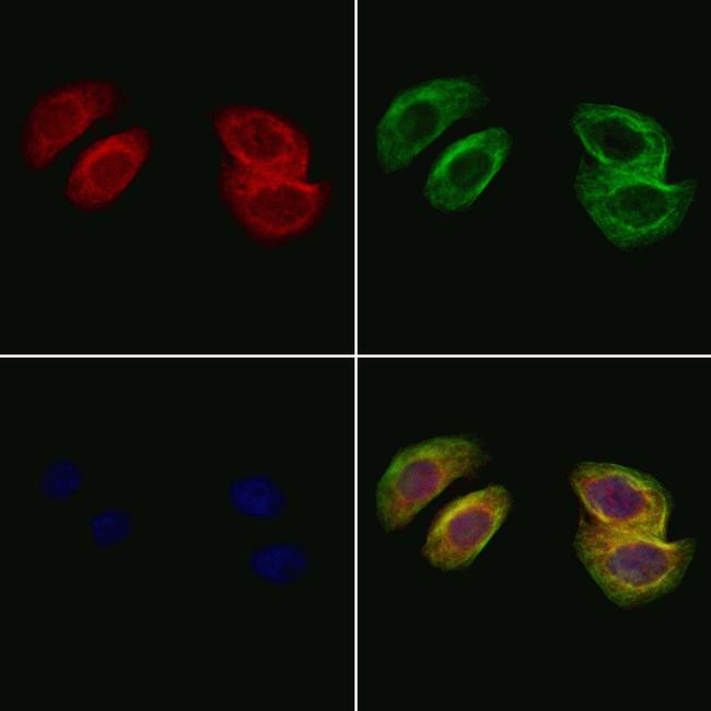 PLA2G2A Antibody in Immunocytochemistry (ICC/IF)