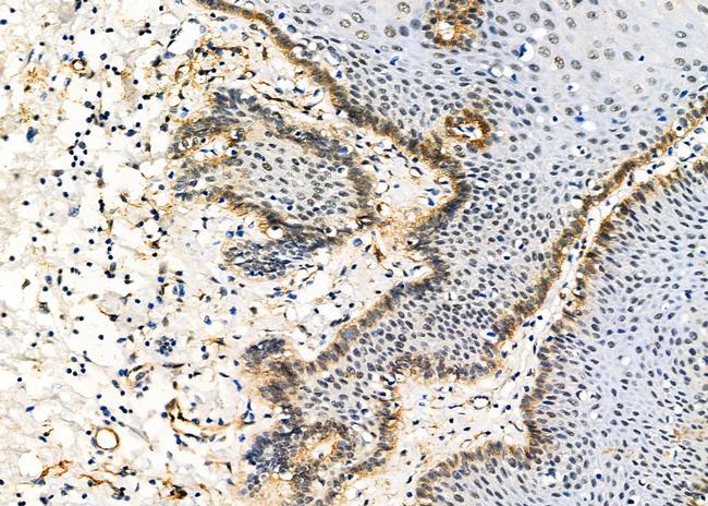 PSMA3 Antibody in Immunohistochemistry (Paraffin) (IHC (P))