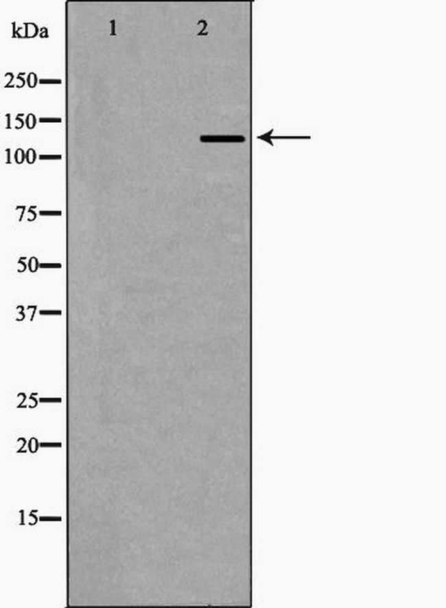 EHMT2 Antibody in Western Blot (WB)