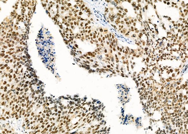 RBBP4 Antibody in Immunohistochemistry (Paraffin) (IHC (P))