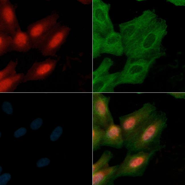 NFATC1 Antibody in Immunocytochemistry (ICC/IF)