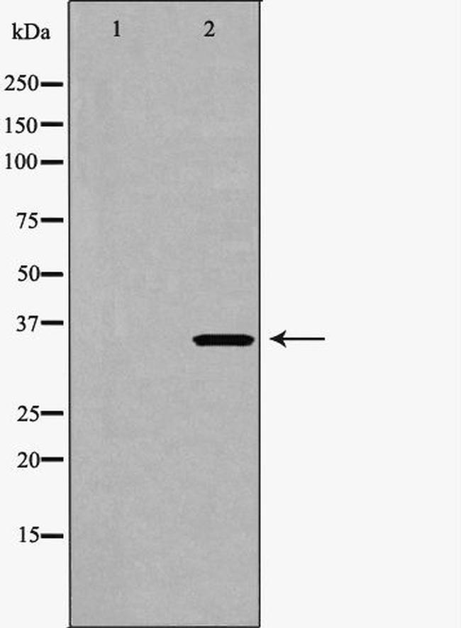 CDK6 Antibody in Western Blot (WB)