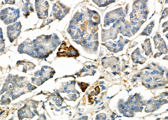 IL-6R Antibody in Immunohistochemistry (Paraffin) (IHC (P))