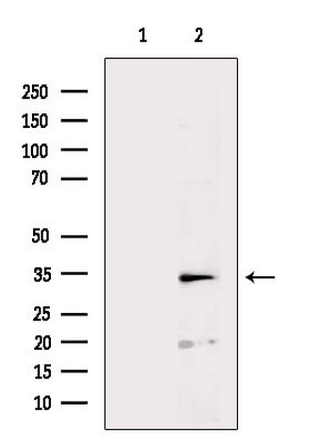 SULT1A1 Antibody in Western Blot (WB)