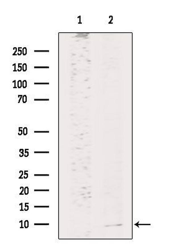 HAMP Antibody in Western Blot (WB)