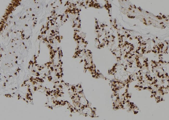 CSNK2A2 Antibody in Immunohistochemistry (Paraffin) (IHC (P))