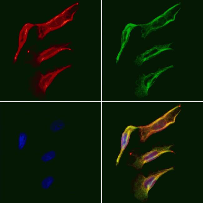 FABP2 Antibody in Immunocytochemistry (ICC/IF)