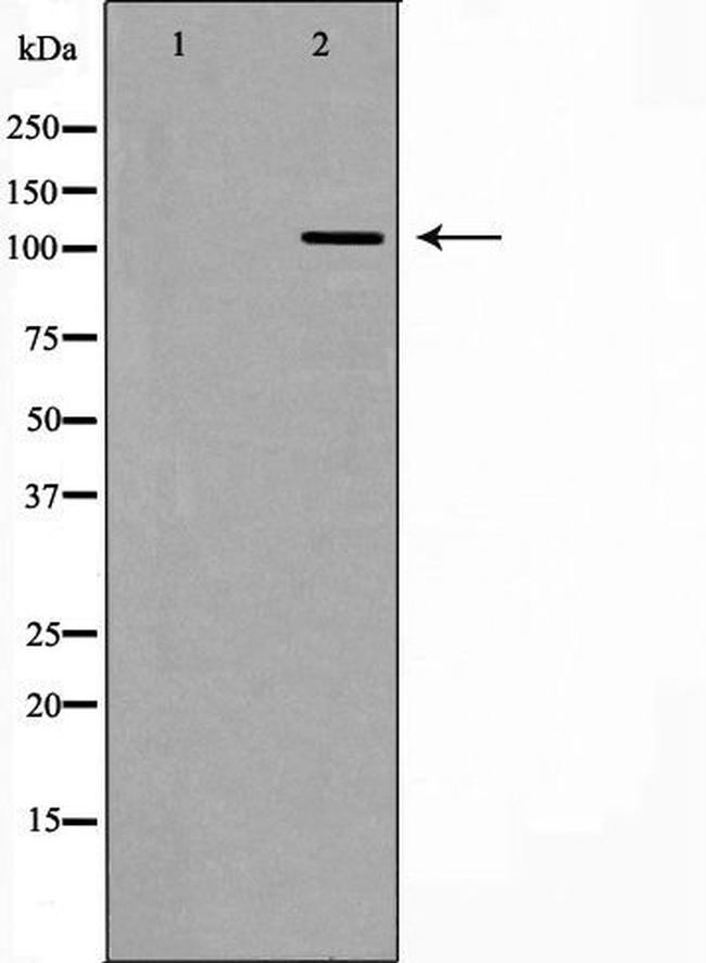 RASA1 Antibody in Western Blot (WB)