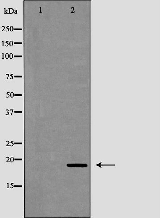 Cathelicidin Antibody in Western Blot (WB)