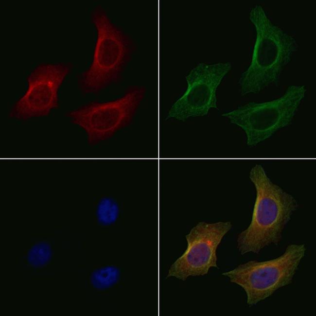 SLC22A5 Antibody in Immunocytochemistry (ICC/IF)