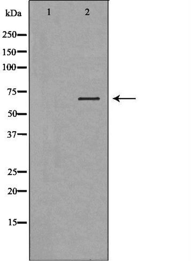 Factor XII Antibody in Western Blot (WB)