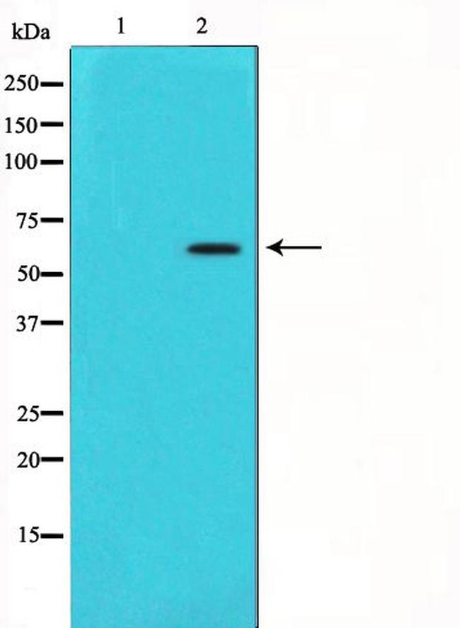 CYP11A1 Antibody in Western Blot (WB)