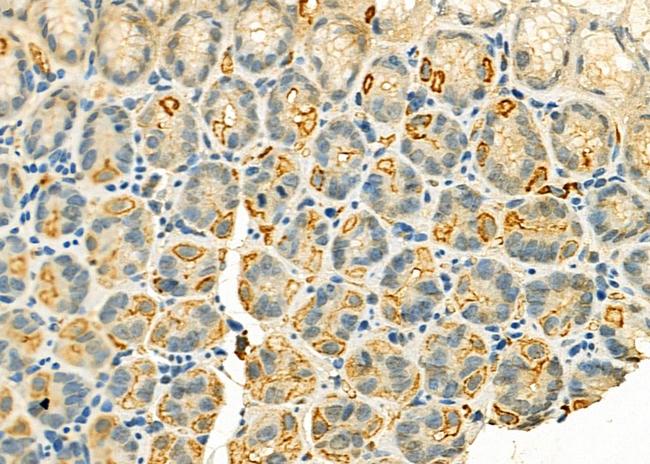 IGFBP5 Antibody in Immunohistochemistry (Paraffin) (IHC (P))