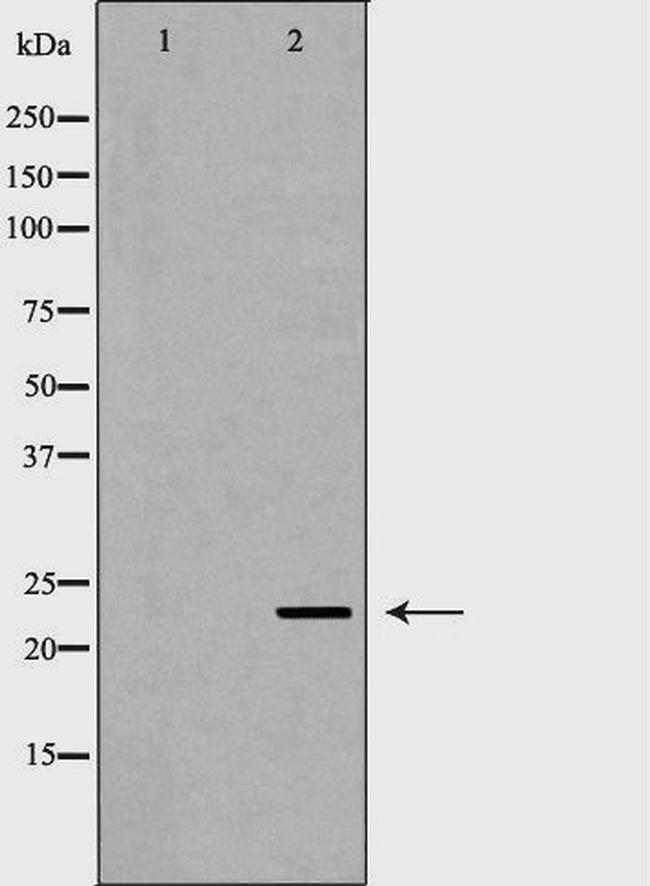 FXN Antibody in Western Blot (WB)