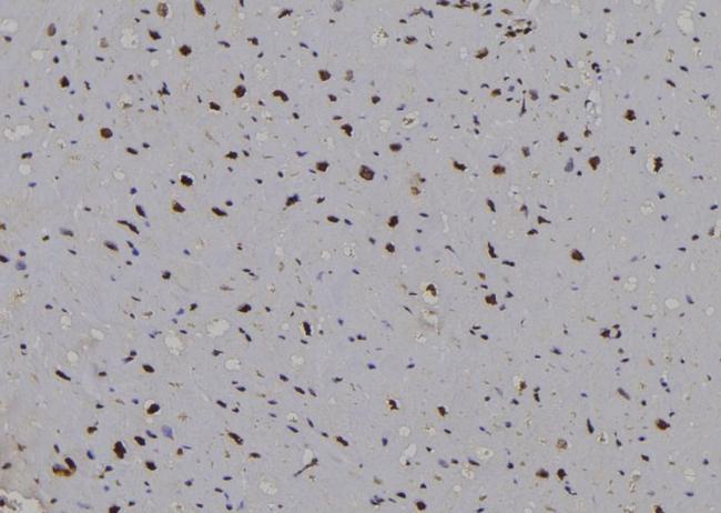 Cyclin D2 Antibody in Immunohistochemistry (Paraffin) (IHC (P))