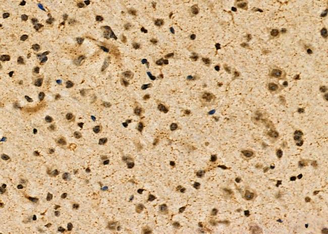 POLR2C Antibody in Immunohistochemistry (Paraffin) (IHC (P))