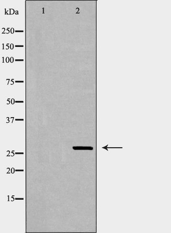 eIF6 Antibody in Western Blot (WB)