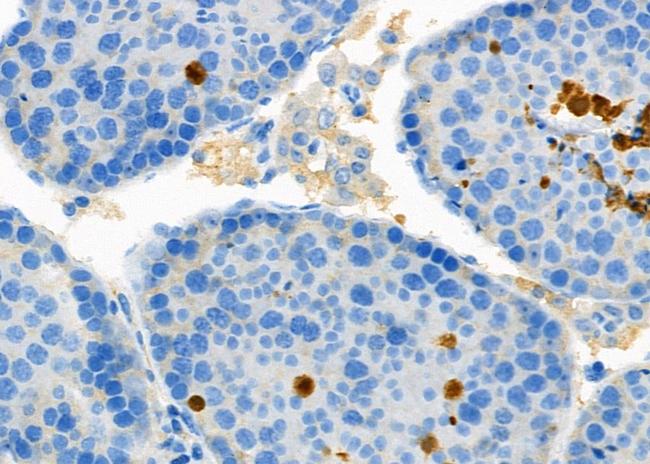 HCFC1 Antibody in Immunohistochemistry (Paraffin) (IHC (P))