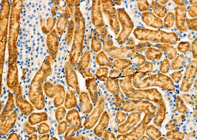 ANT Antibody in Immunohistochemistry (Paraffin) (IHC (P))