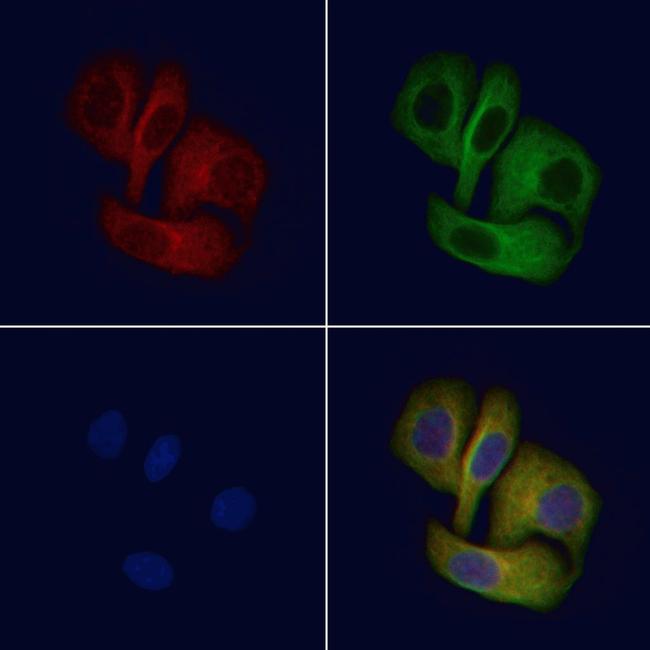 EPHX2 Antibody in Immunocytochemistry (ICC/IF)