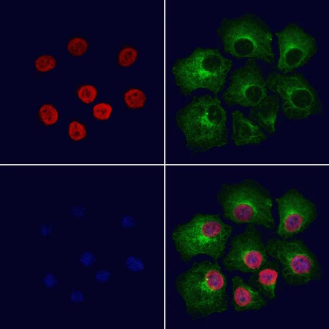 RUVBL2 Antibody in Immunocytochemistry (ICC/IF)