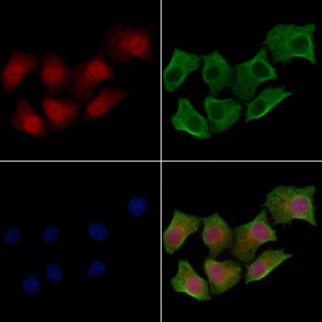 HOXA9 Antibody in Immunocytochemistry (ICC/IF)