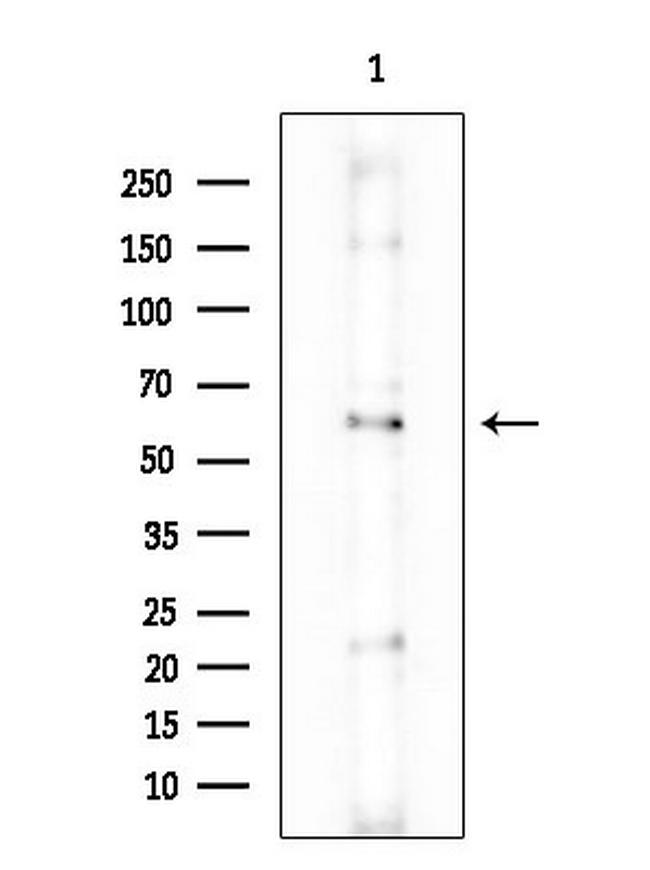 Uromodulin Antibody in Western Blot (WB)