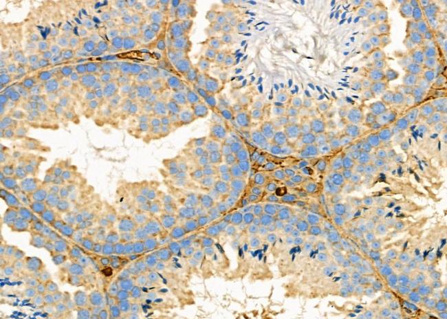 ODC1 Antibody in Immunohistochemistry (Paraffin) (IHC (P))