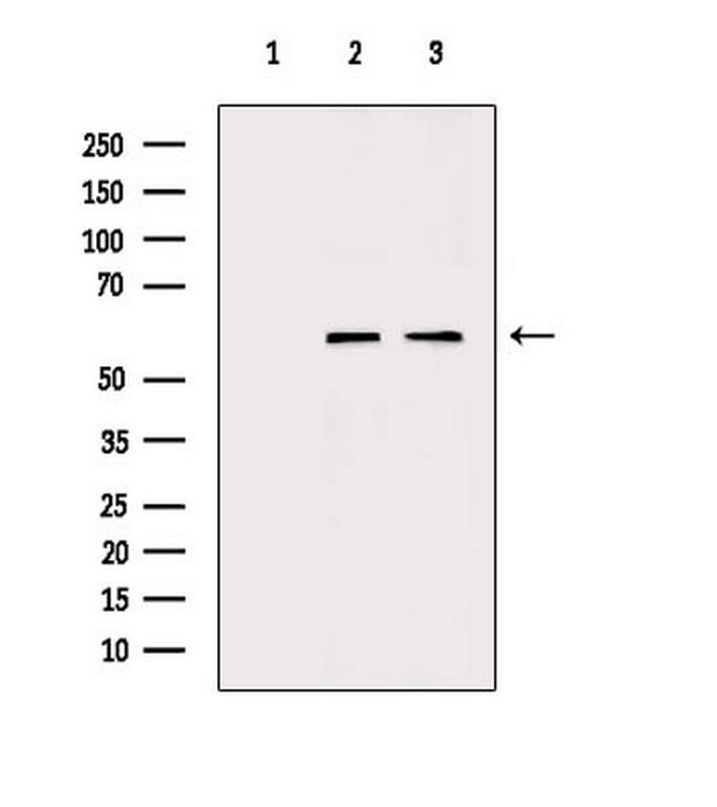 TCP1 Antibody in Western Blot (WB)