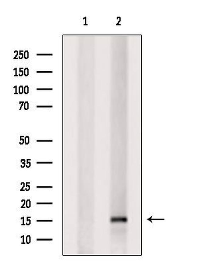 NDP Antibody in Western Blot (WB)