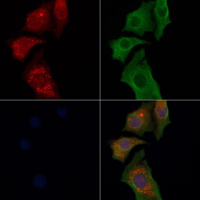 Tapasin Antibody in Immunocytochemistry (ICC/IF)