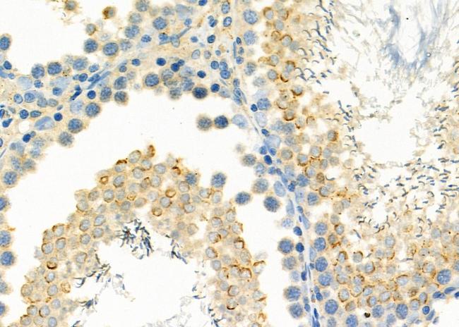 MB67 Antibody in Immunohistochemistry (Paraffin) (IHC (P))