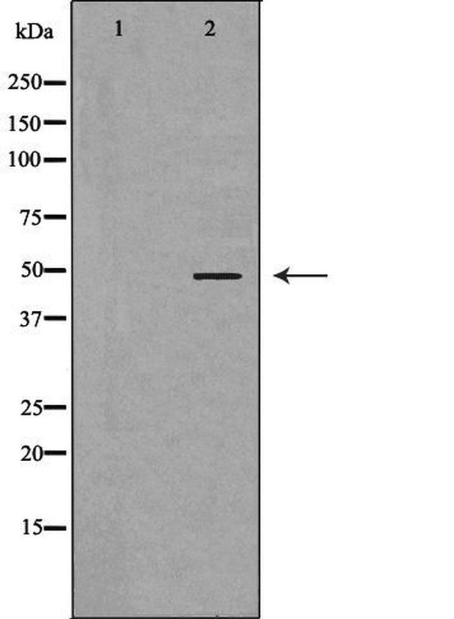 KCNN4 Antibody in Western Blot (WB)