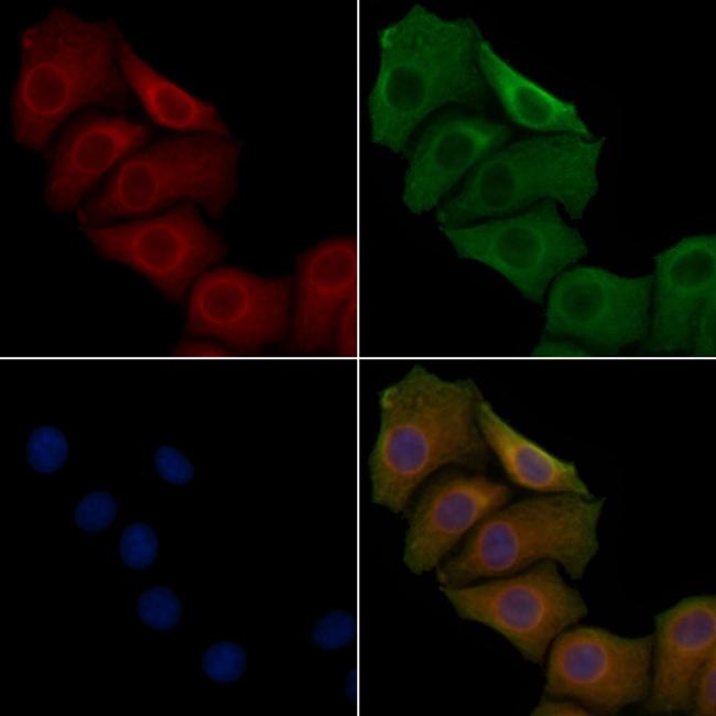 HSD17B2 Antibody in Immunocytochemistry (ICC/IF)