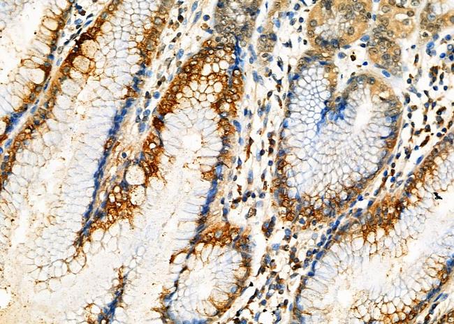 IPO5 Antibody in Immunohistochemistry (Paraffin) (IHC (P))