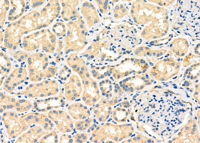 Cbl-b Antibody in Immunohistochemistry (Paraffin) (IHC (P))