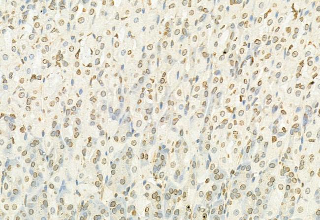 MT2A Antibody in Immunohistochemistry (Paraffin) (IHC (P))