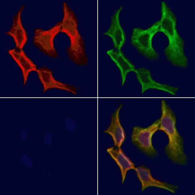 Tryptase Antibody in Immunocytochemistry (ICC/IF)