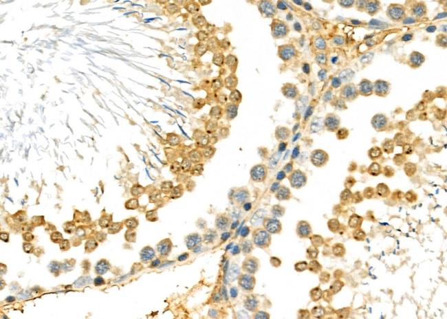 WDR5 Antibody in Immunohistochemistry (Paraffin) (IHC (P))