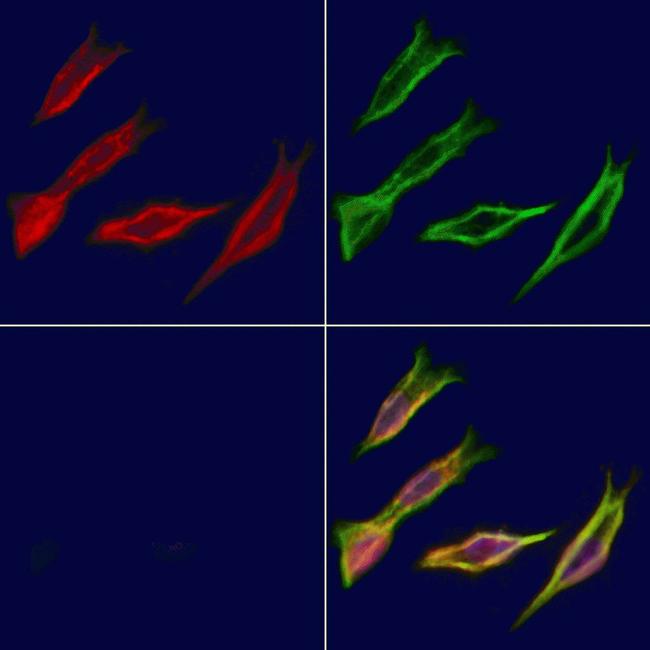 ADH5 Antibody in Immunocytochemistry (ICC/IF)