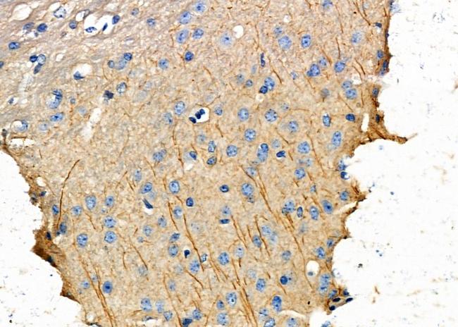 EPHX1 Antibody in Immunohistochemistry (Paraffin) (IHC (P))