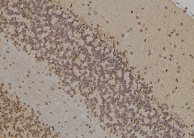 FANCD2 Antibody in Immunohistochemistry (Paraffin) (IHC (P))