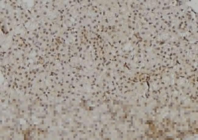 POLR2A Antibody in Immunohistochemistry (Paraffin) (IHC (P))