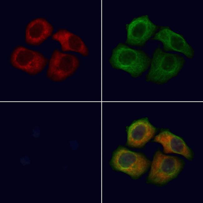 Thrombospondin 1 Antibody in Immunocytochemistry (ICC/IF)